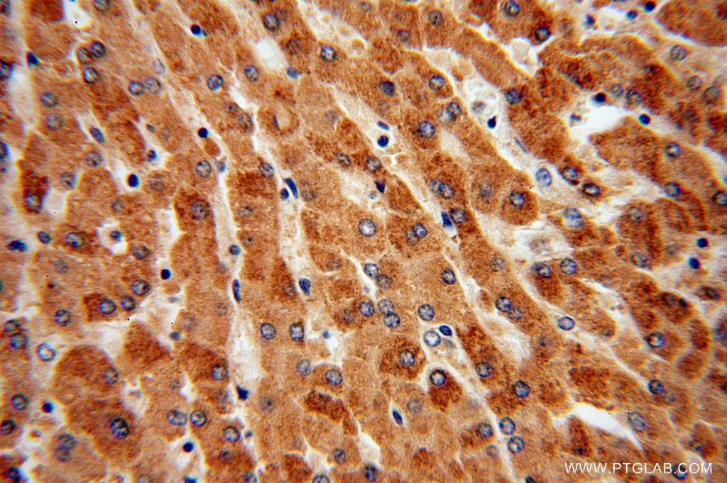 TCTN2 Polyclonal antibody