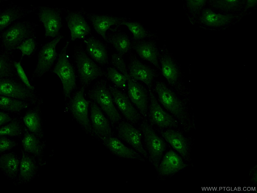 INTS7 Polyclonal antibody