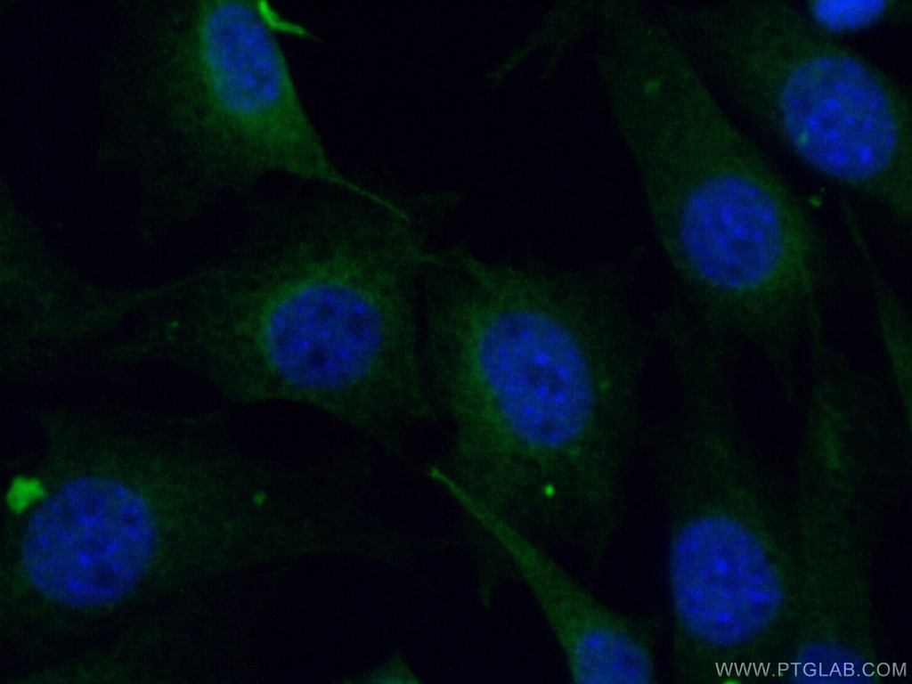 UBE2F Polyclonal antibody