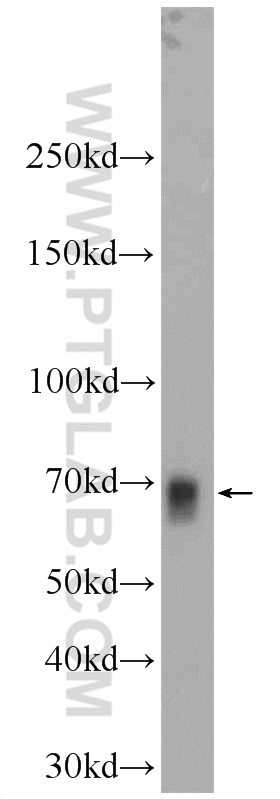 NFE2L1 Polyclonal antibody
