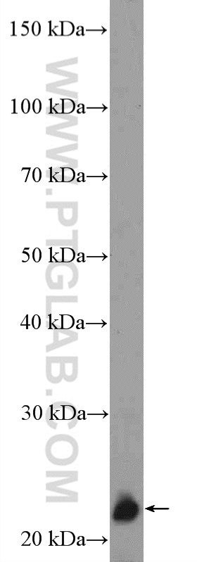 ZNF22 Polyclonal antibody