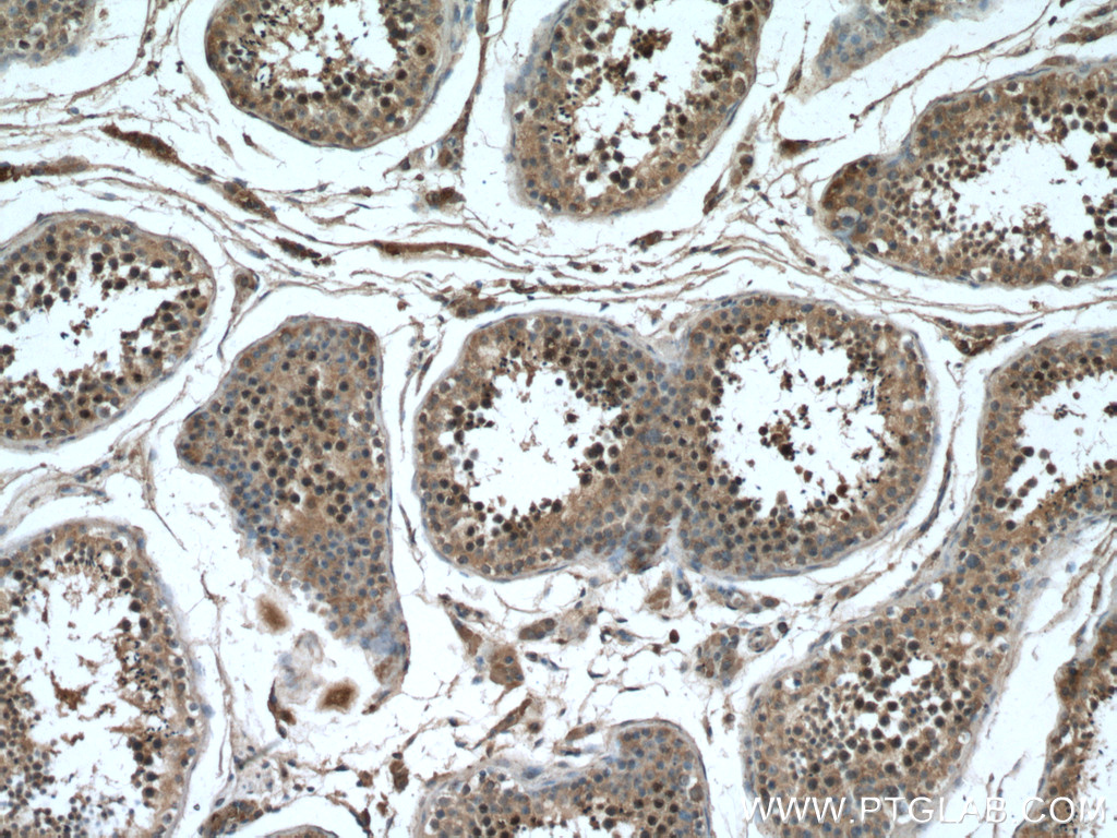 TEX12 Polyclonal antibody