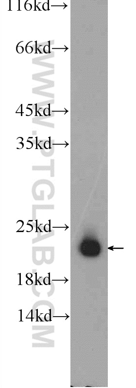 SPANXB1 Polyclonal antibody