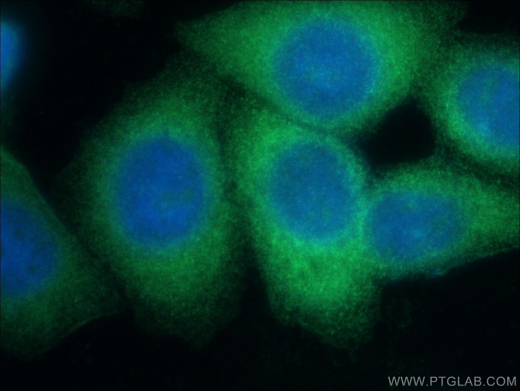 LZTFL1 Polyclonal antibody