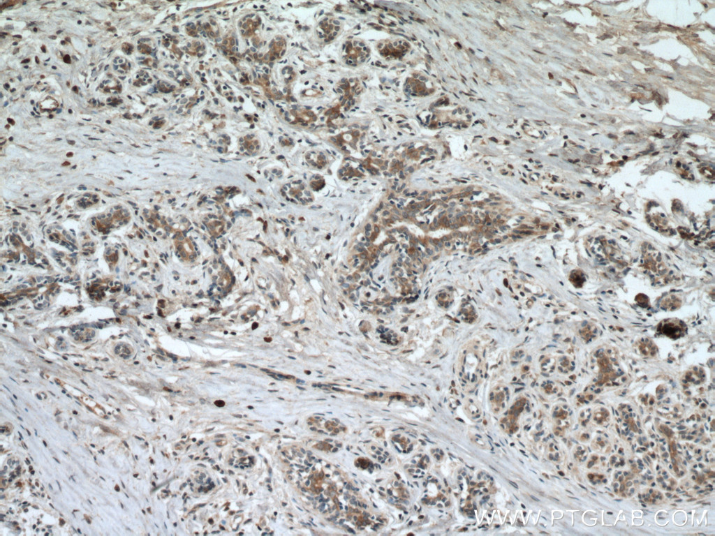 CST6 Polyclonal antibody