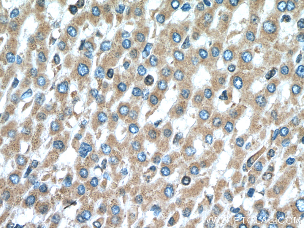 PIP4K2C Polyclonal antibody