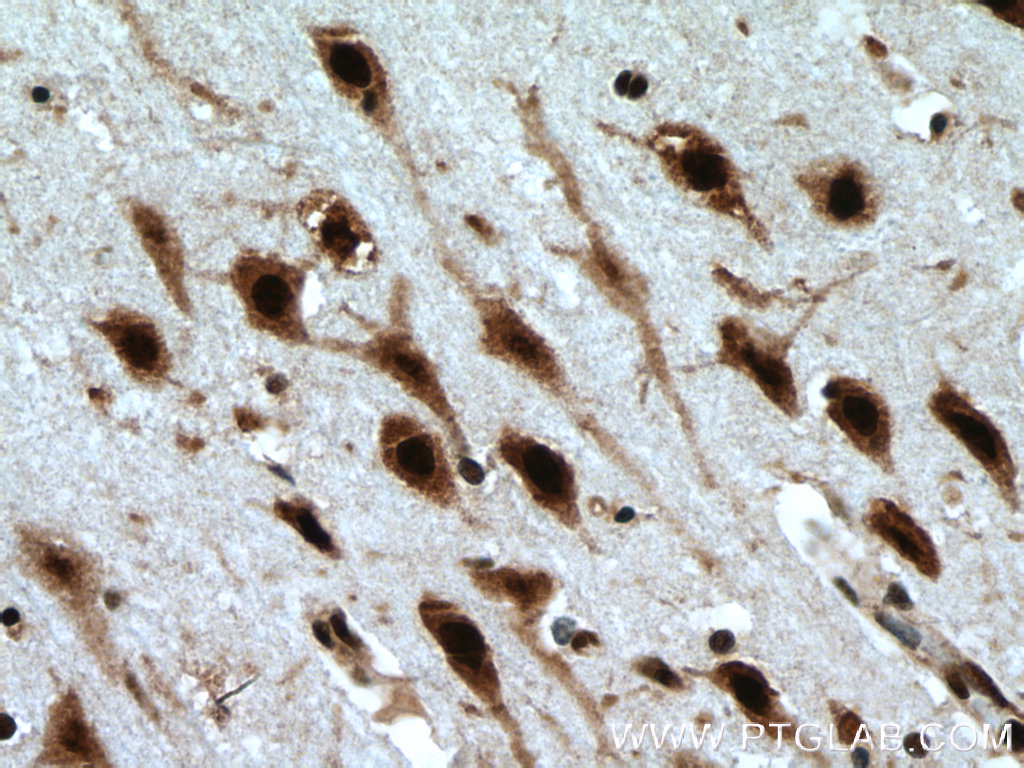 LUC7L Polyclonal antibody