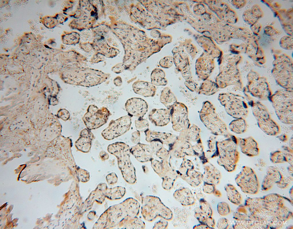 TUBGCP4 Polyclonal antibody