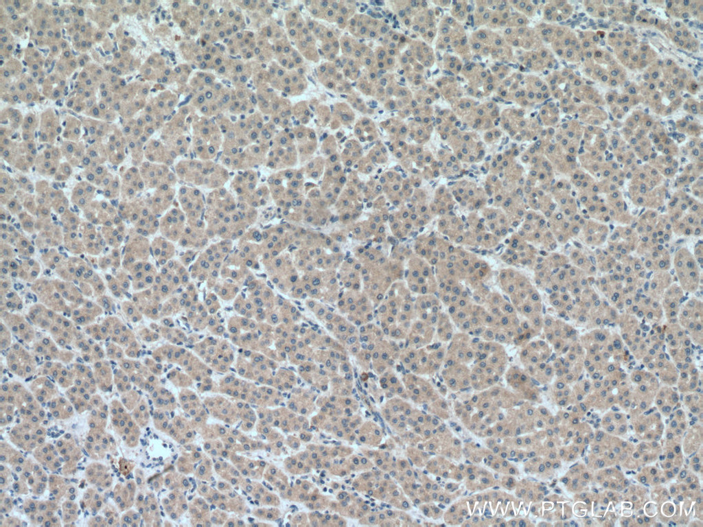 METTL7A Polyclonal antibody