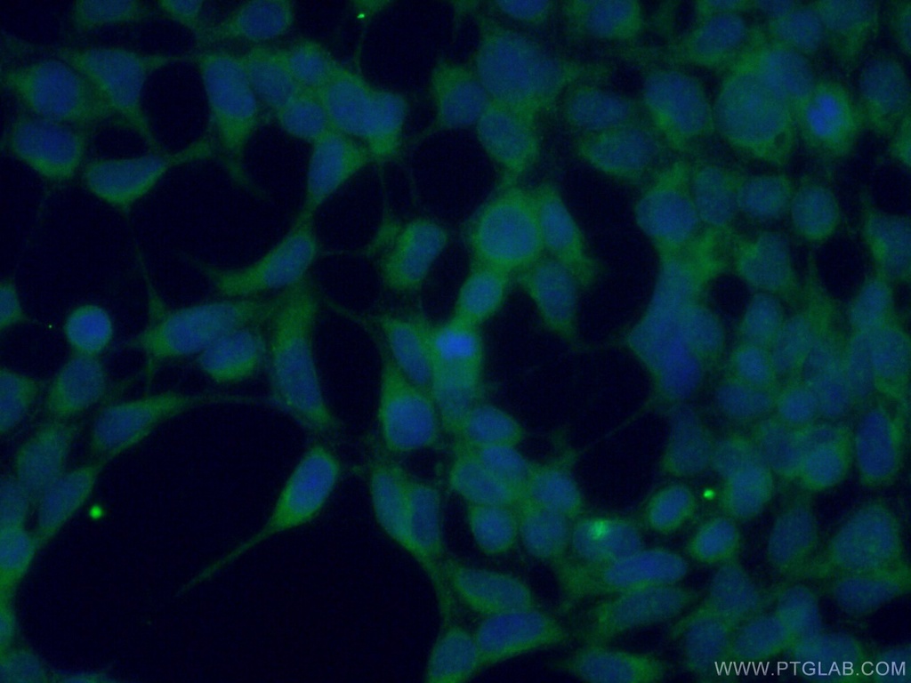 SPHK2 Polyclonal antibody