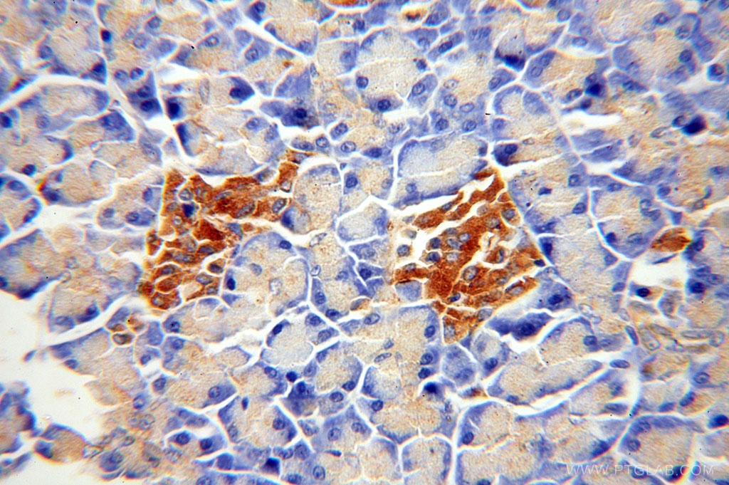 ATP6V1A Polyclonal antibody