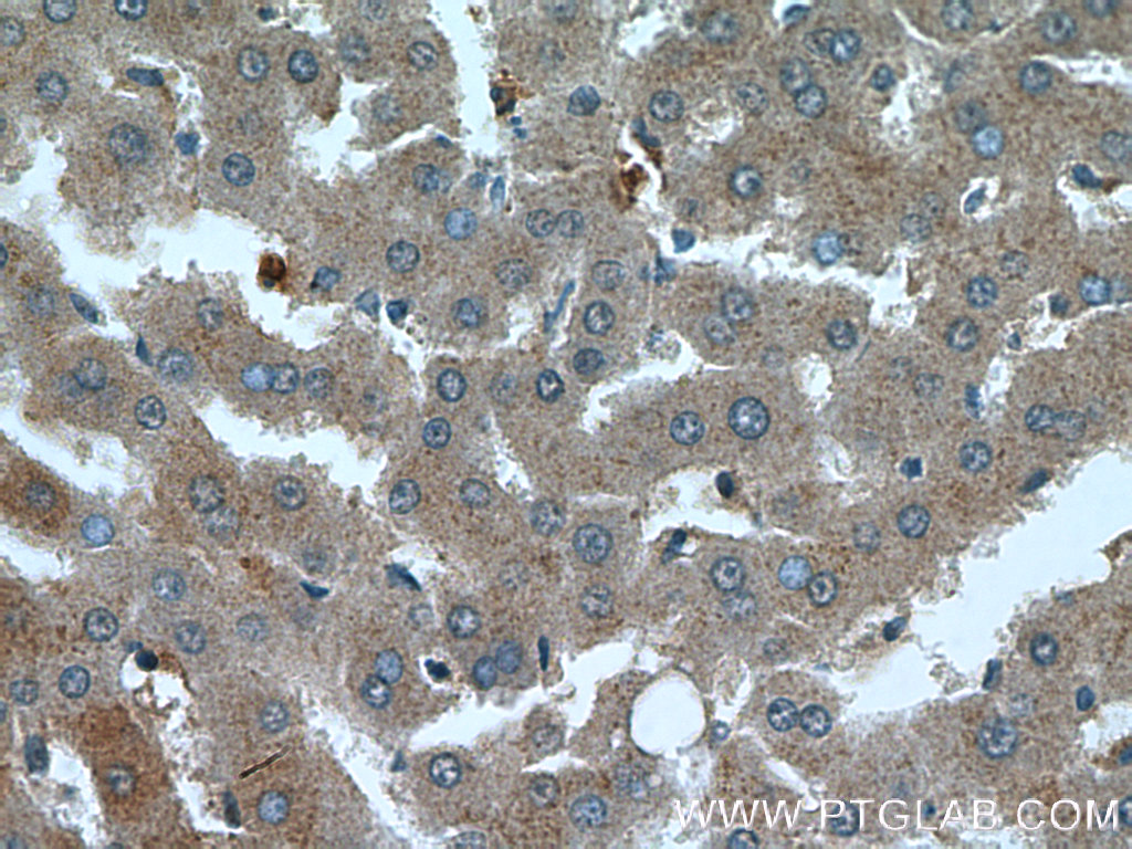 OMA1 Polyclonal antibody