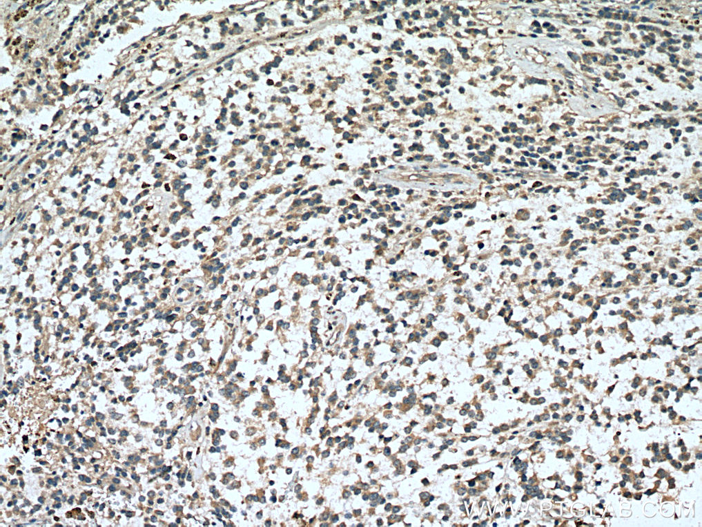 RASGEF1A Polyclonal antibody