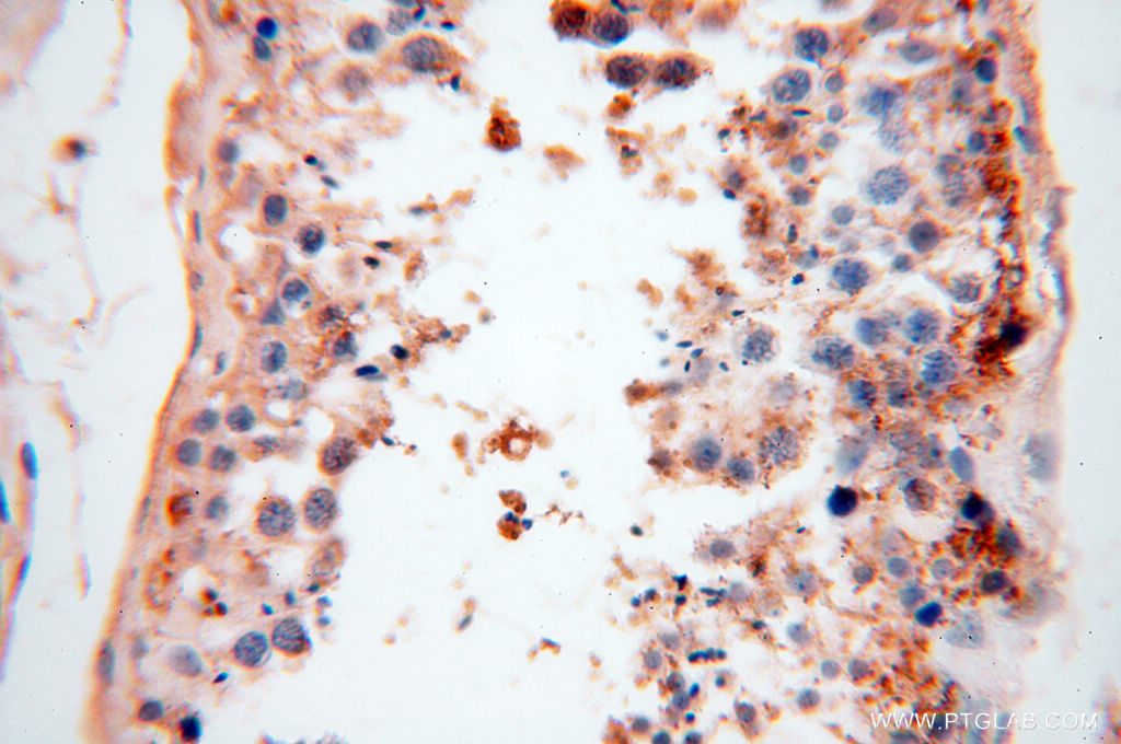 CSNK1A1L Polyclonal antibody