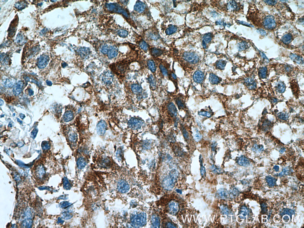 ACSS1 Polyclonal antibody