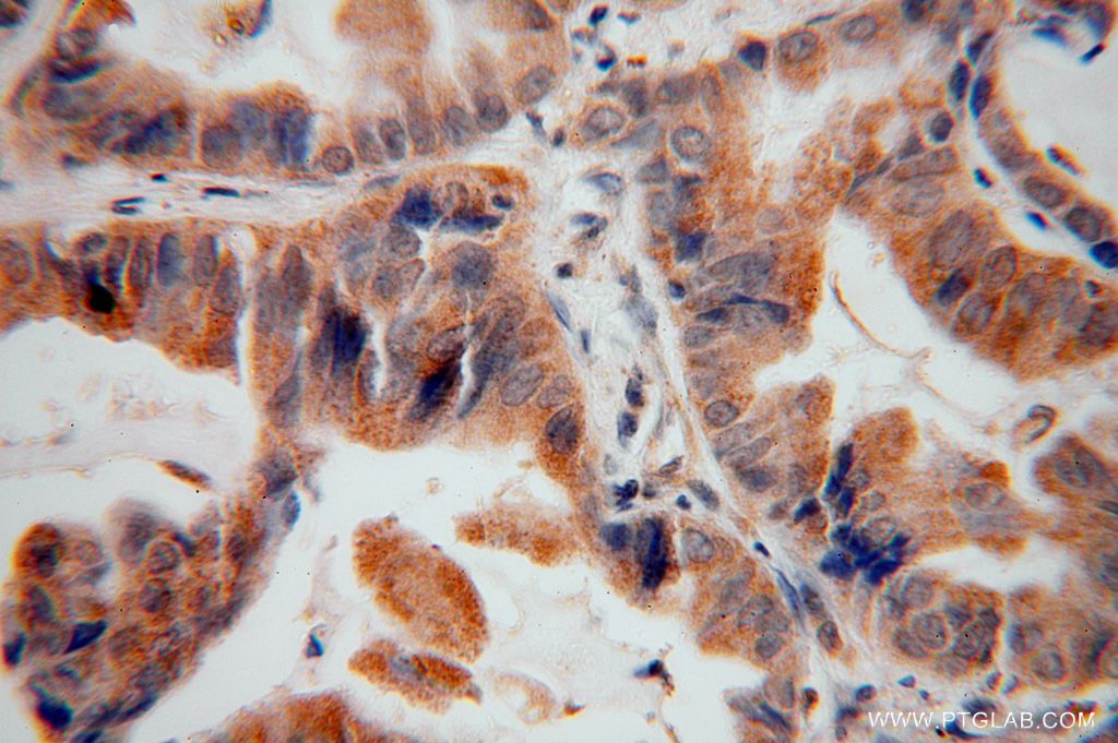 FCRLB Polyclonal antibody