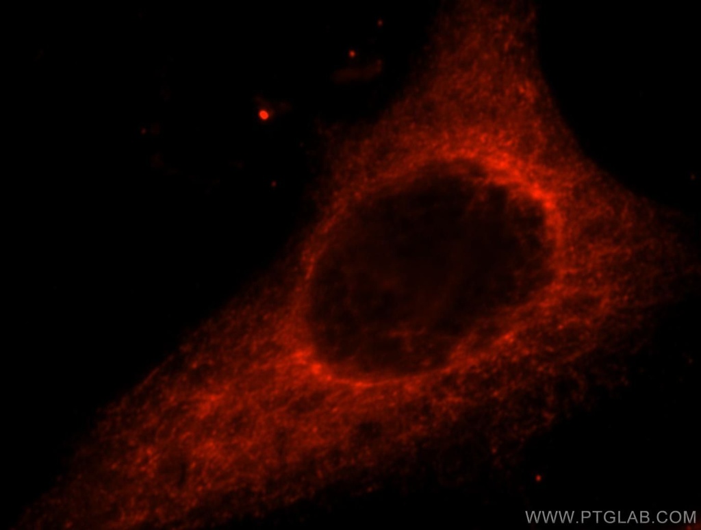 ACAD10 Polyclonal antibody