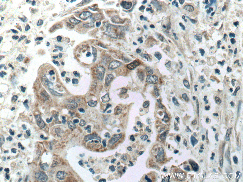 ADH1B Polyclonal antibody