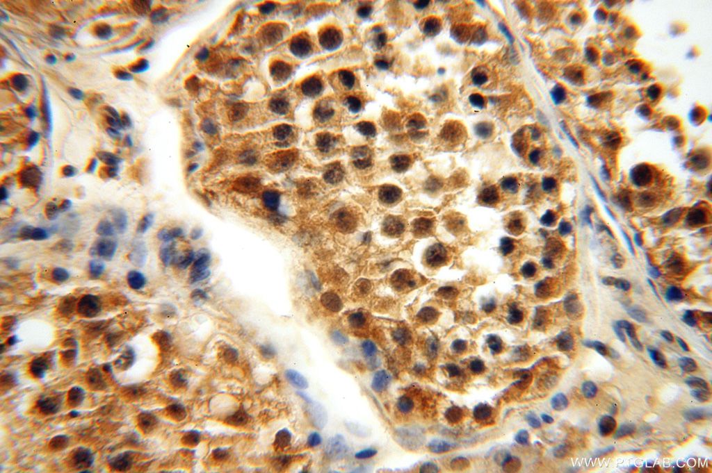 APOBEC4 Polyclonal antibody