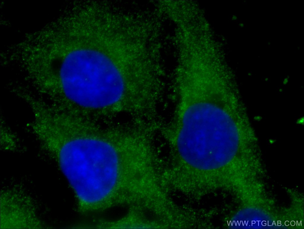 LOH12CR1 Polyclonal antibody