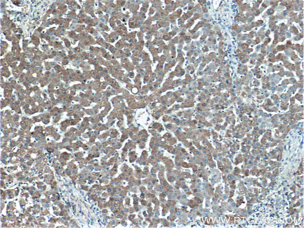 MT1X Polyclonal antibody