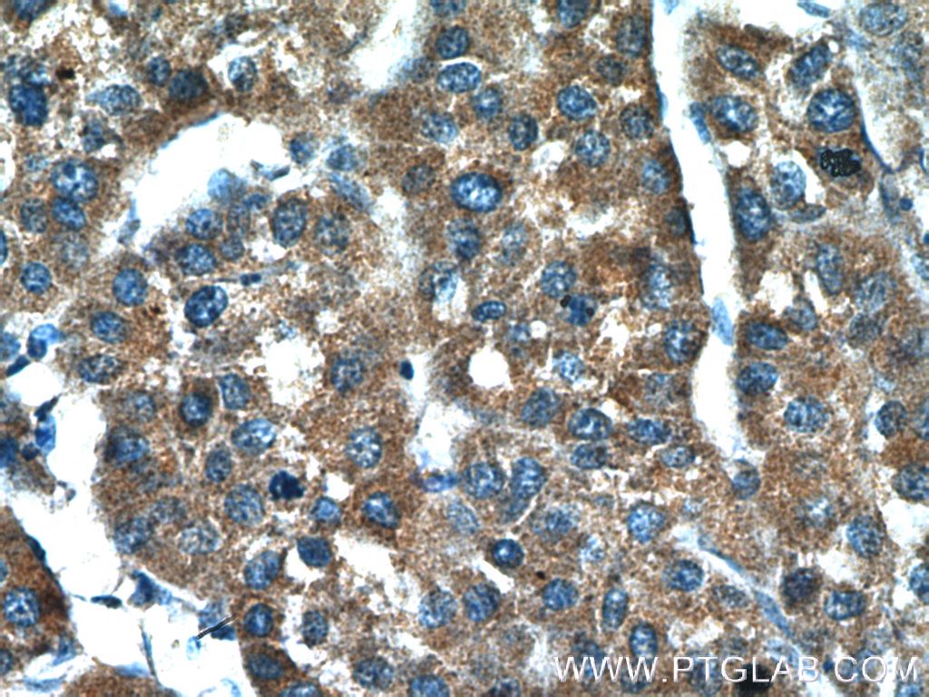 BPGM Polyclonal antibody