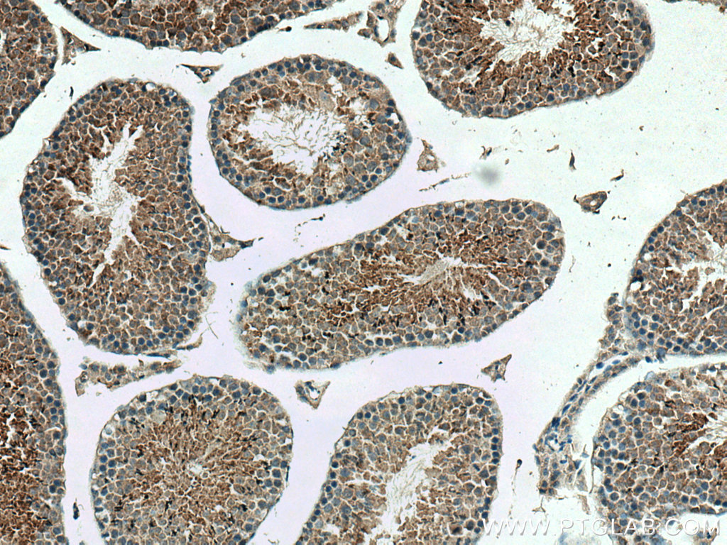 DNAJB3 Polyclonal antibody