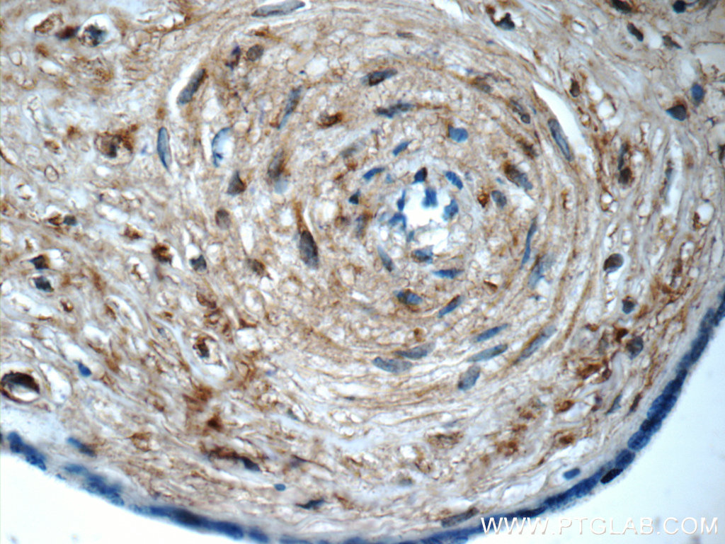 LETM2 Polyclonal antibody