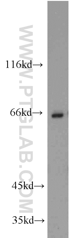 CBFA2T3 Polyclonal antibody