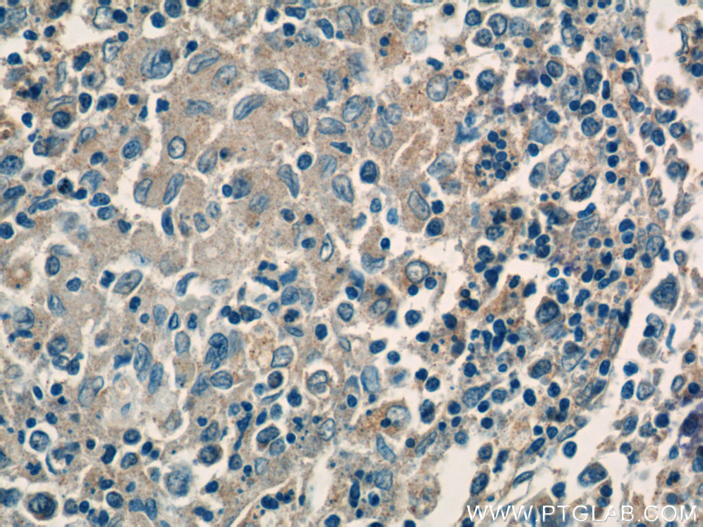 CFP Polyclonal antibody