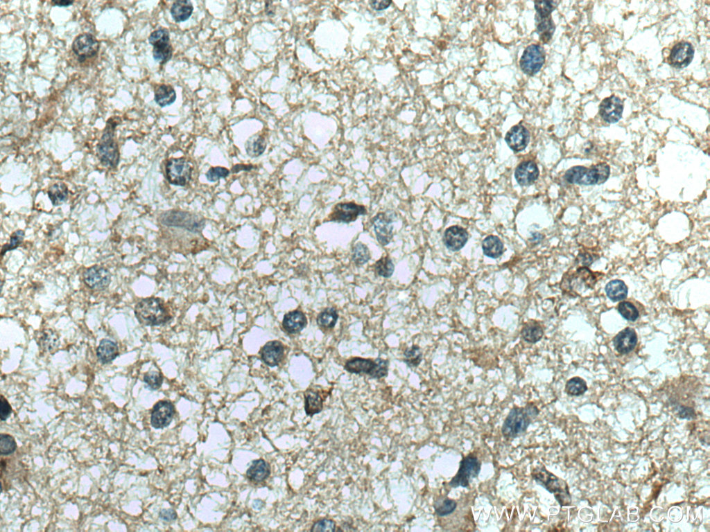 RNASE11 Polyclonal antibody