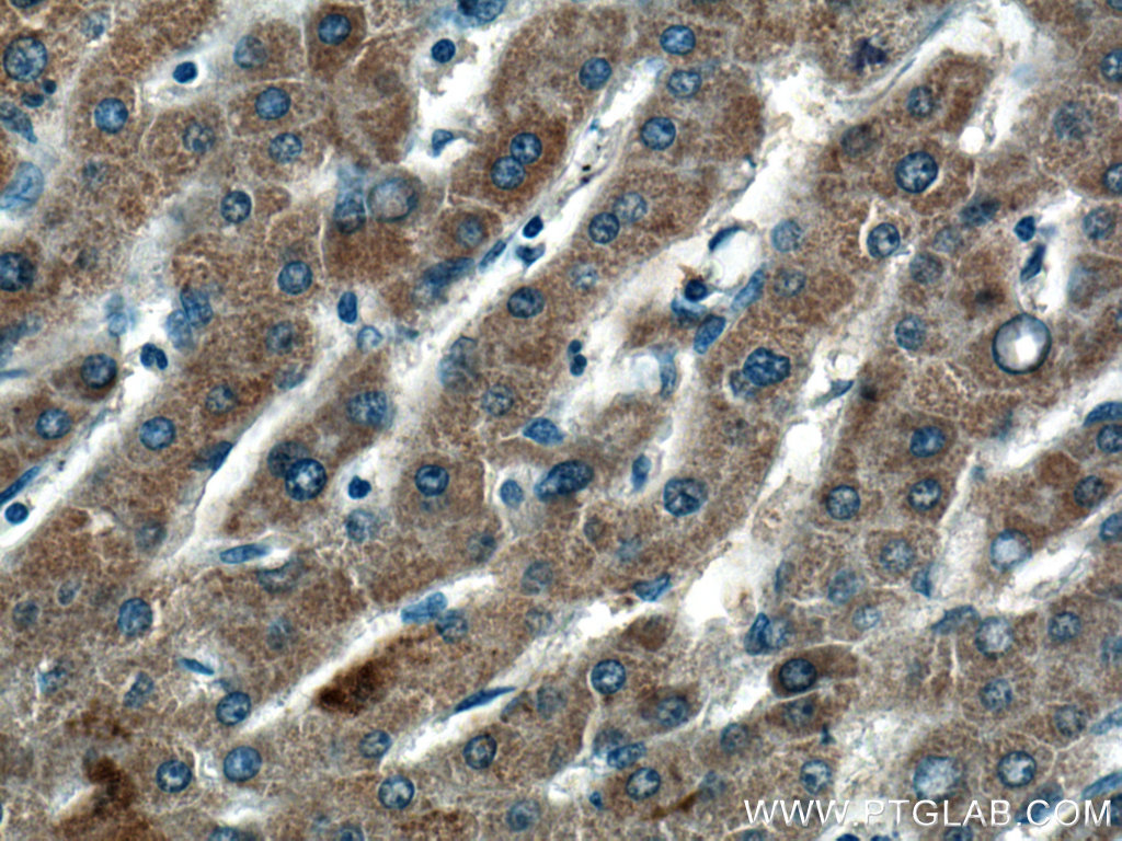 HMGCLL1 Polyclonal antibody