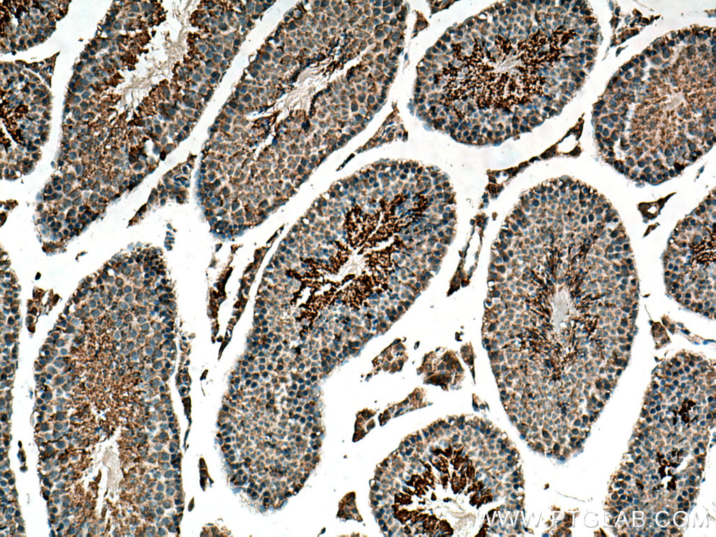 GPD2 Polyclonal antibody