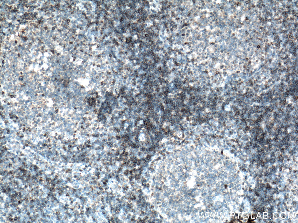 CD5 Polyclonal antibody