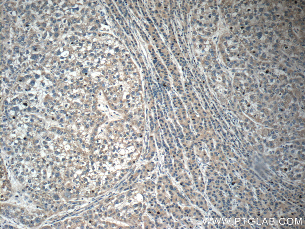 C6 Polyclonal antibody