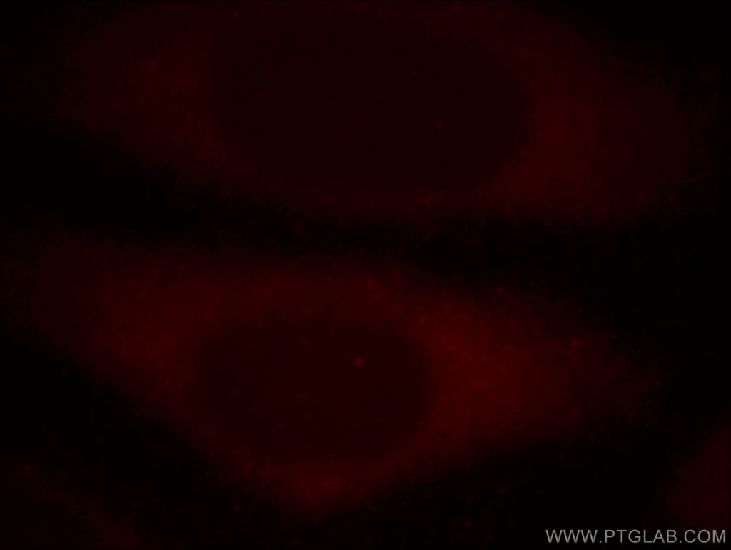 RB1CC1 Polyclonal antibody