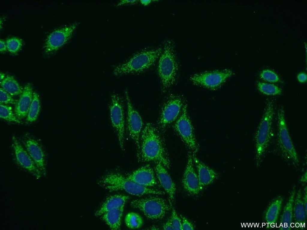 Collagen Type VIII Polyclonal antibody