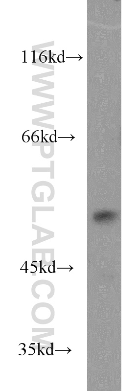 DUS1L Polyclonal antibody
