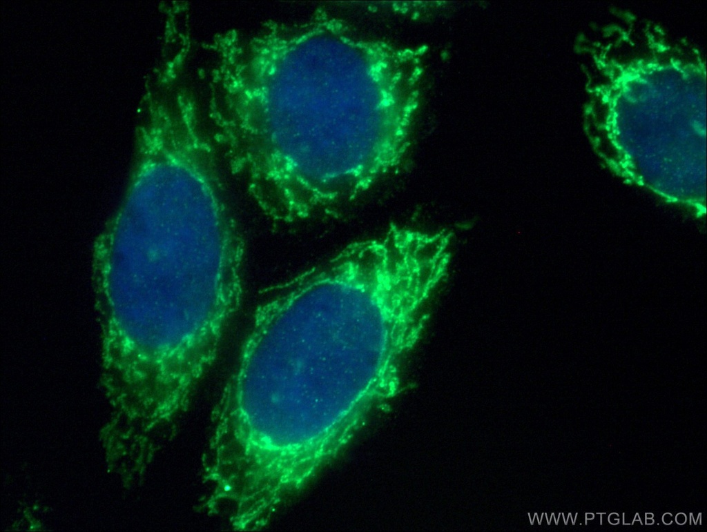 SARS2 Polyclonal antibody