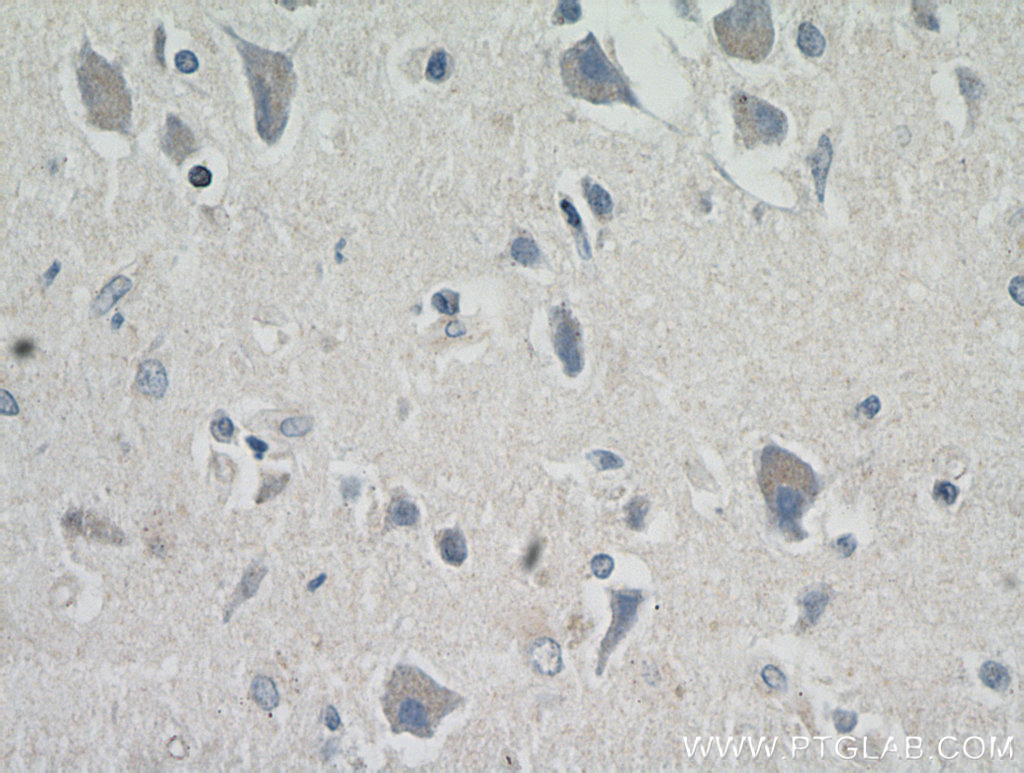 MRAP2 Polyclonal antibody