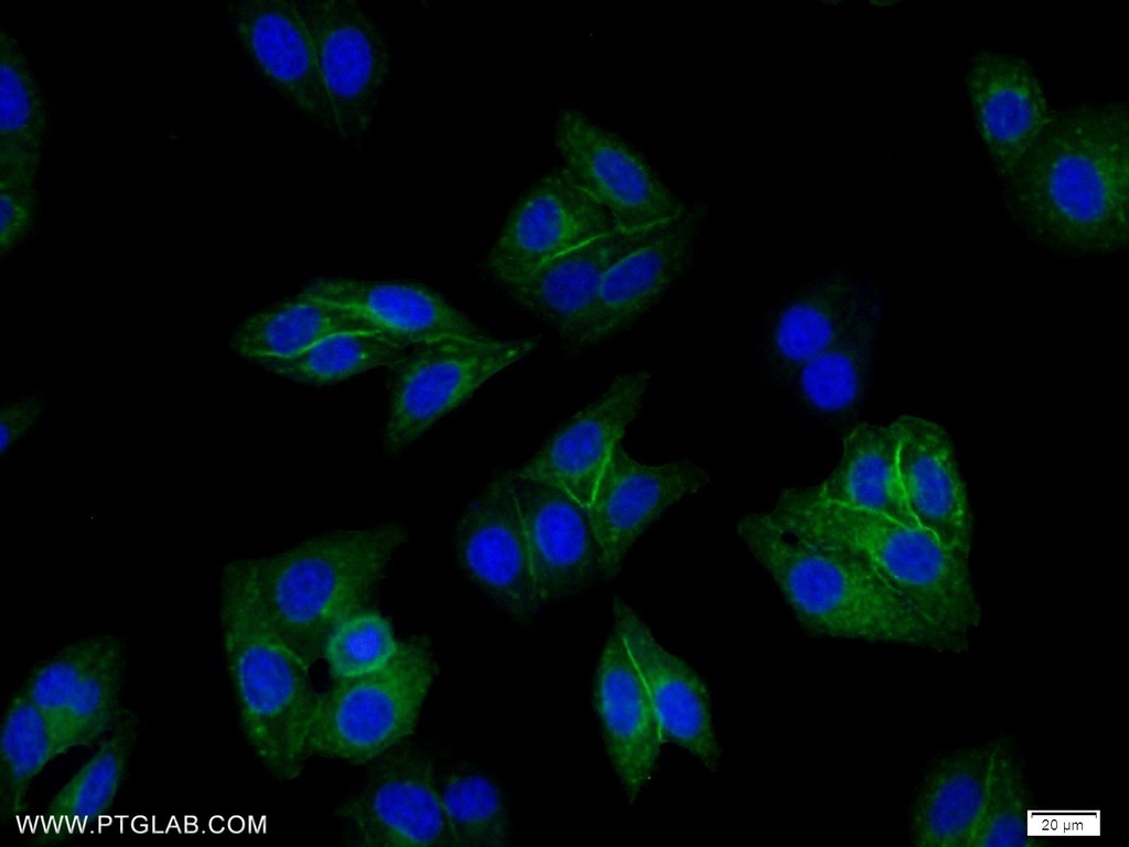 HLA class I (HLA-B) Polyclonal antibody