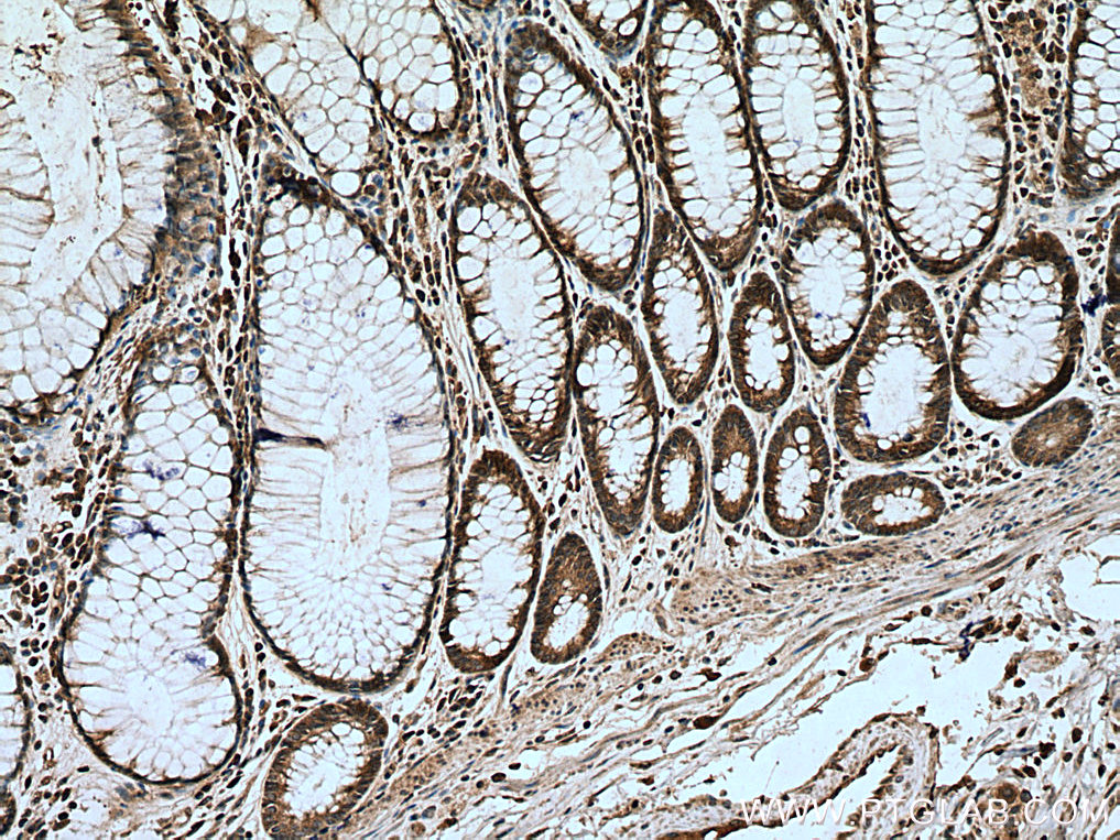 RUNDC1 Polyclonal antibody