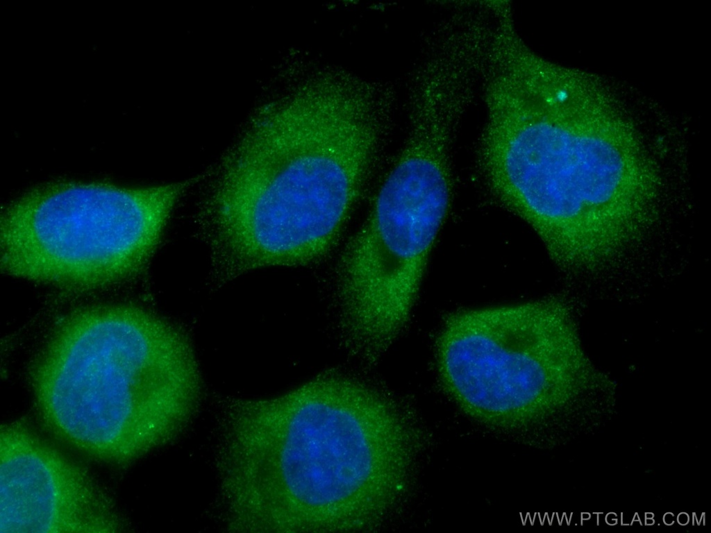 CALML3 Polyclonal antibody