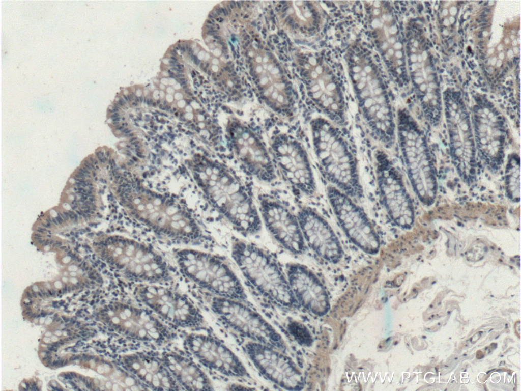 EFCAB1 Polyclonal antibody