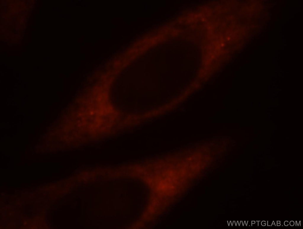 RPS4Y1 Polyclonal antibody