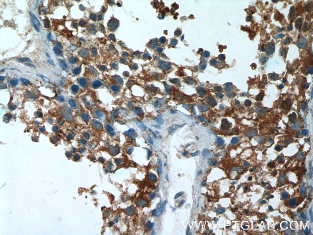 AGA Polyclonal antibody