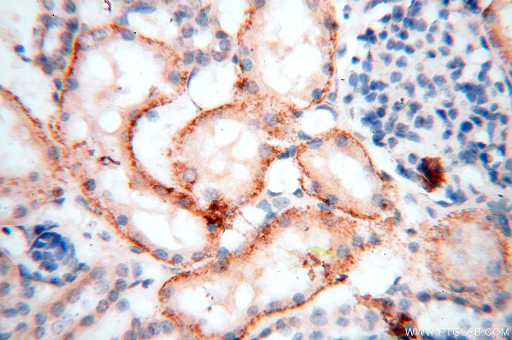 HSD17B11 Polyclonal antibody