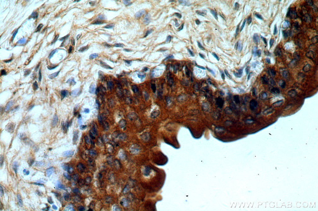 TGDS Polyclonal antibody