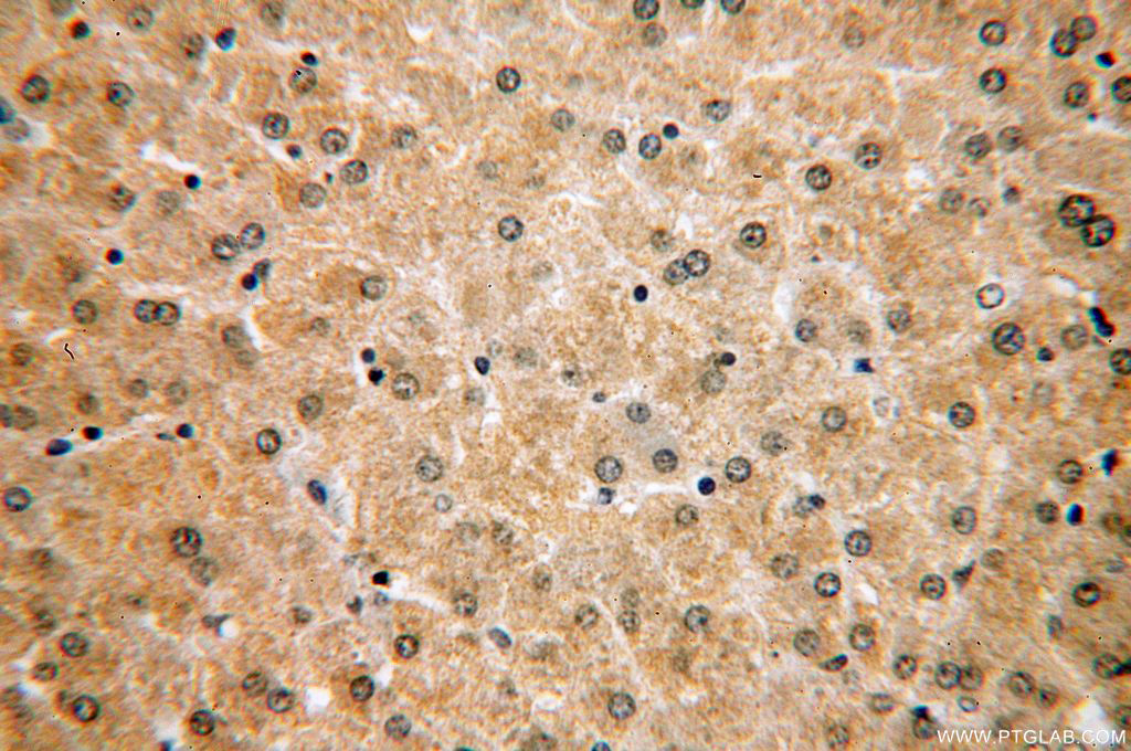 CLYBL Polyclonal antibody