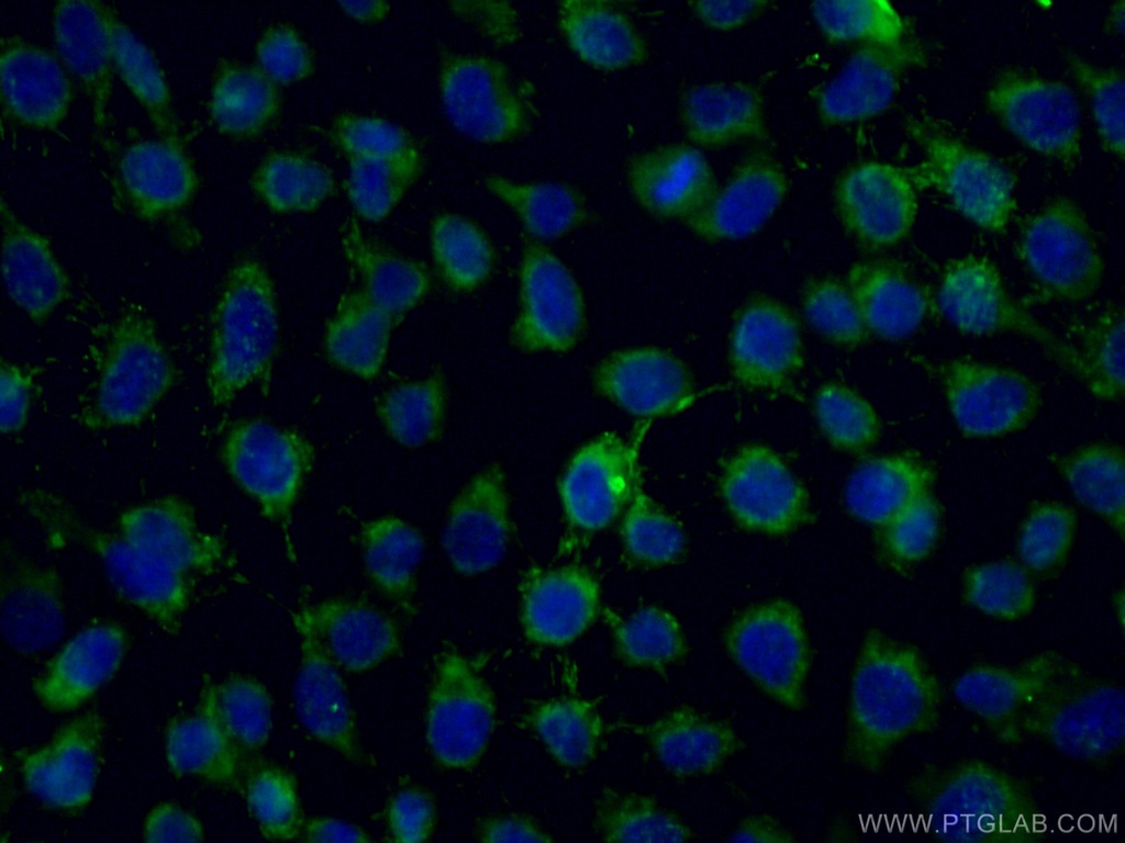 ALDH5A1 Polyclonal antibody
